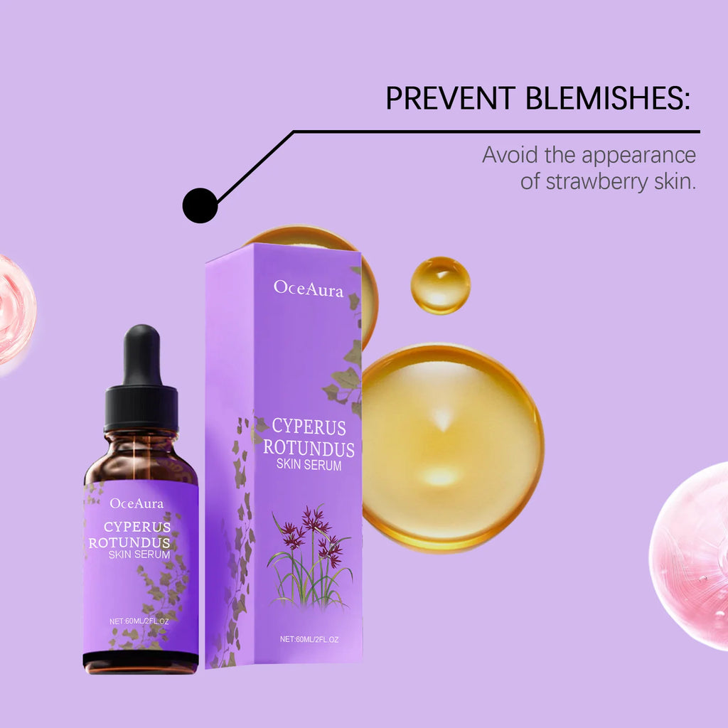 Cyperus Rotundus Skin Serum