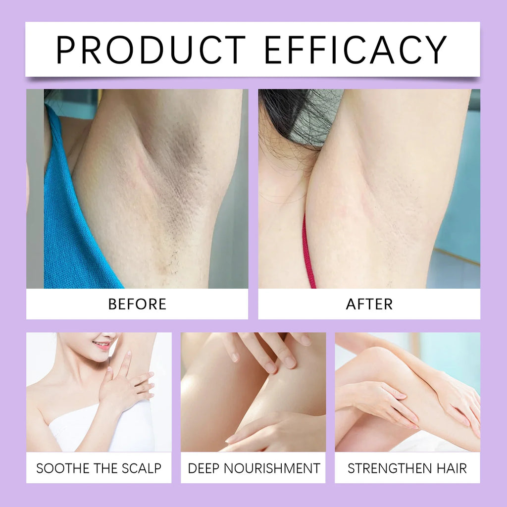 Cyperus Rotundus Skin Serum