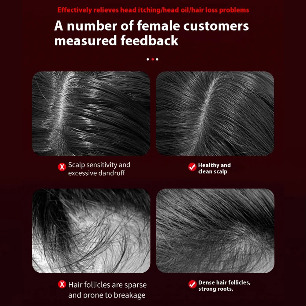 Electric Massage Comb with Built-in Red Light Therapy