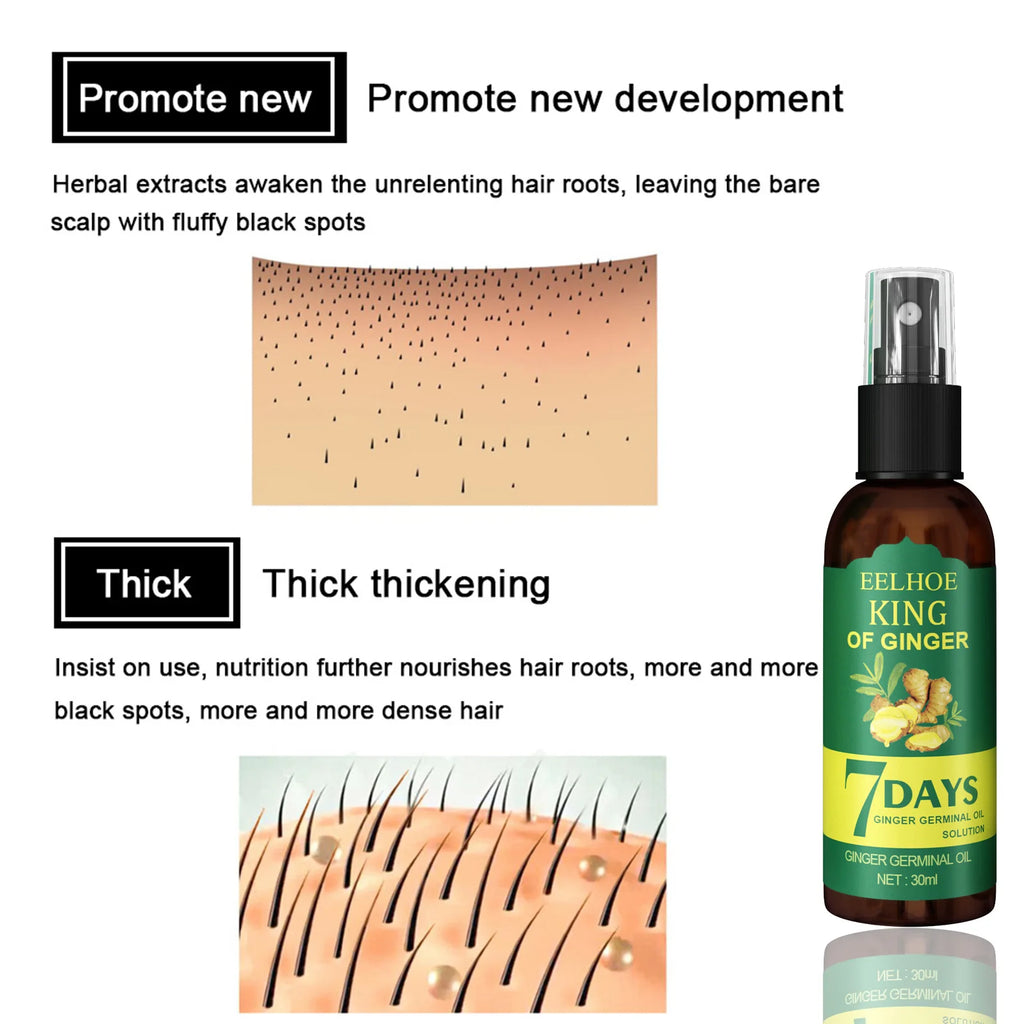 Ginger Hair Growth Spray – Scalp Repair & Hair Strengthening Treatment