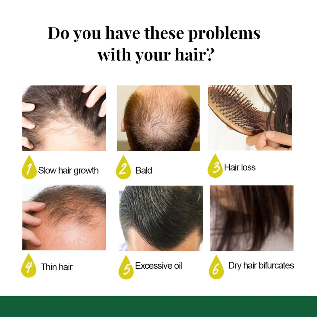 Ginger Hair Growth Spray – Scalp Repair & Hair Strengthening Treatment