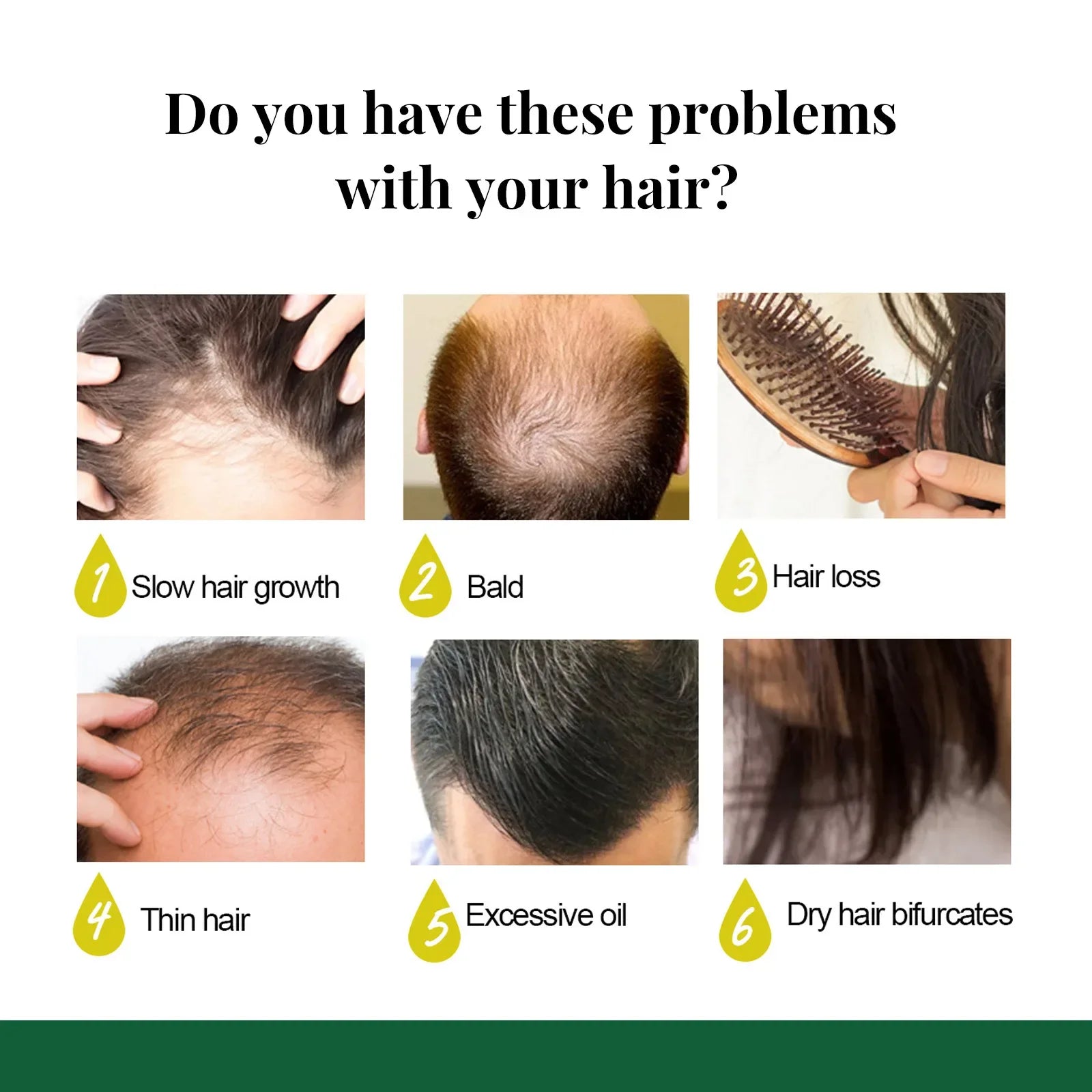 Ginger Hair Growth Spray – Scalp Repair & Hair Strengthening Treatment